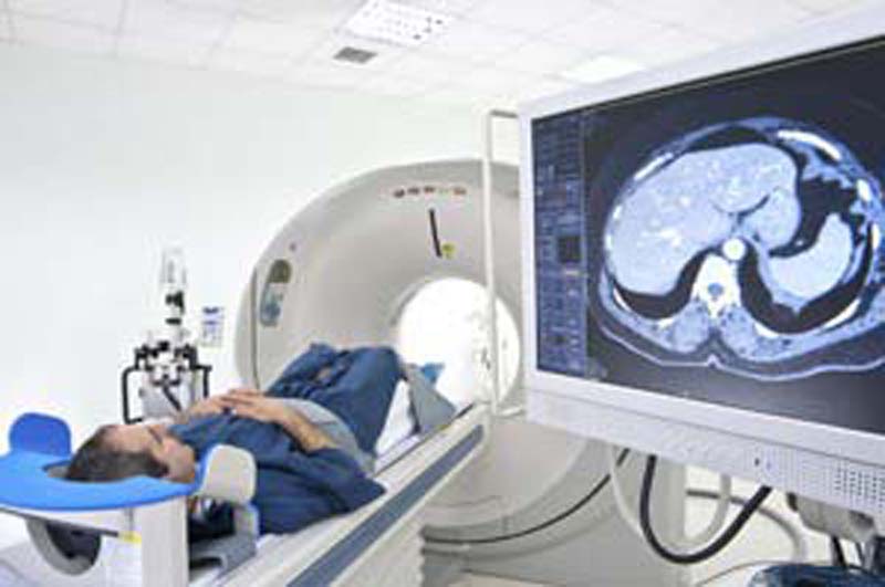 Brain Cancer